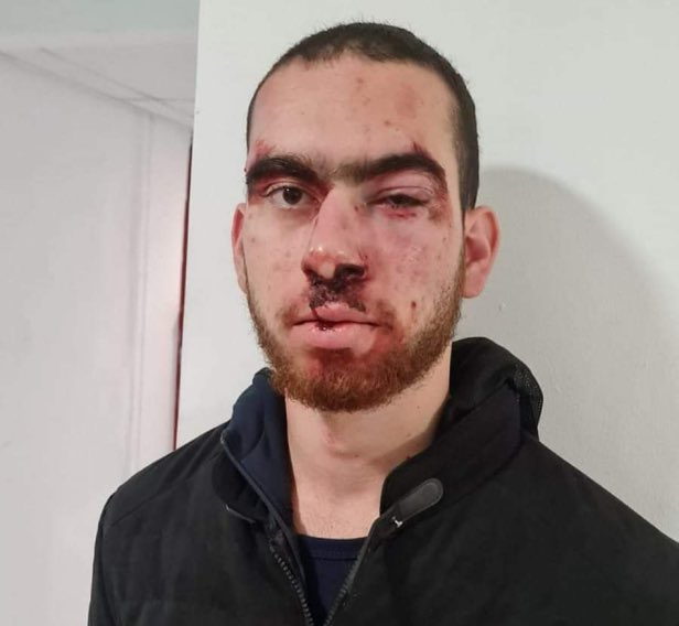 Israeli barbarian "soldiers" brutally beat up a Palestinian man for being part of a vigil in Um al-Fahm calling for Hisham Abu Hawash's release