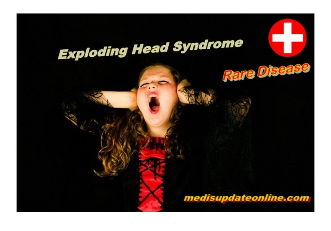 drMuhHasan's tweet photo. Exploding head syndrome (EHS) is rare disease sleep disorder that allows a sufferer to hear loud sound such as bomb exploding in the head during deep sleep

#raredisease
#medisupdate
#explodingheadsyndrome

Read more : https://t.co/E7UNfB5jN9 https://t.co/QWL0uKXeoK