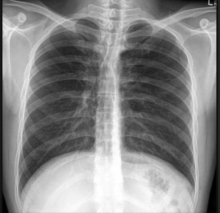 #radialfirst but no!!! 👻