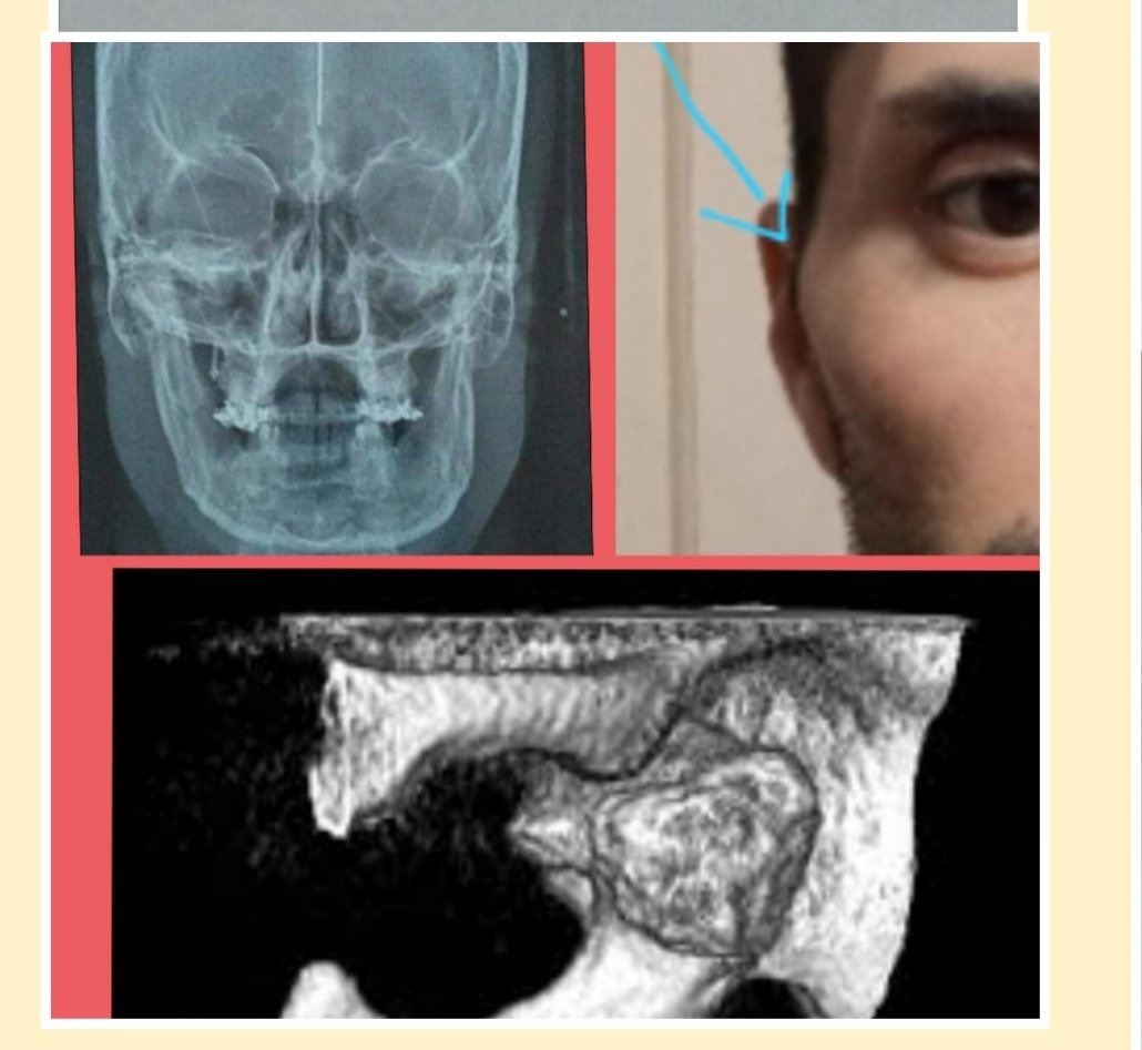 madorni's tweet photo. Estimados, hagamos que todo esto valga la pena.

Luis sufre de un dolor crónico insoportable y mareos permanentes: debe operarse de “hiperplasia condilar”. Necesita reunir 6.000 USD para dejar esto atrás.

Hagamos entre todos que él pueda tener un gran comienzo de año. https://t.co/TOMrNZ3PwW