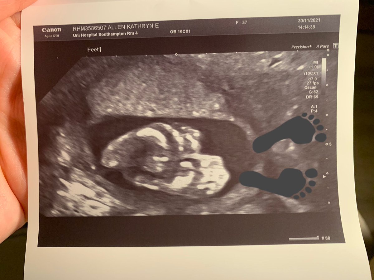 We have some exciting news for this New Year. ⭐

Our lovely Kathryn will be bringing two new little feet 👣 into the world this April as she looks forward to the arrival of a baby boy! 💙

This is such lovely news for the Active Step family! Congrats!

#NewBaby #LittleFeet #Cute