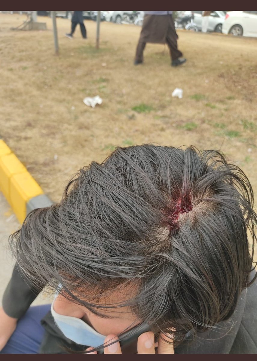 Sharef_Kakar's tweet photo. Once again the goons of IJT attack on the peaceful student of IIUI.
These terrorist elements must be ban with in campuses.
#BanTerroristIJT
#SaveIIUI
#SaveTheStudents https://t.co/BrYxEi2gEy