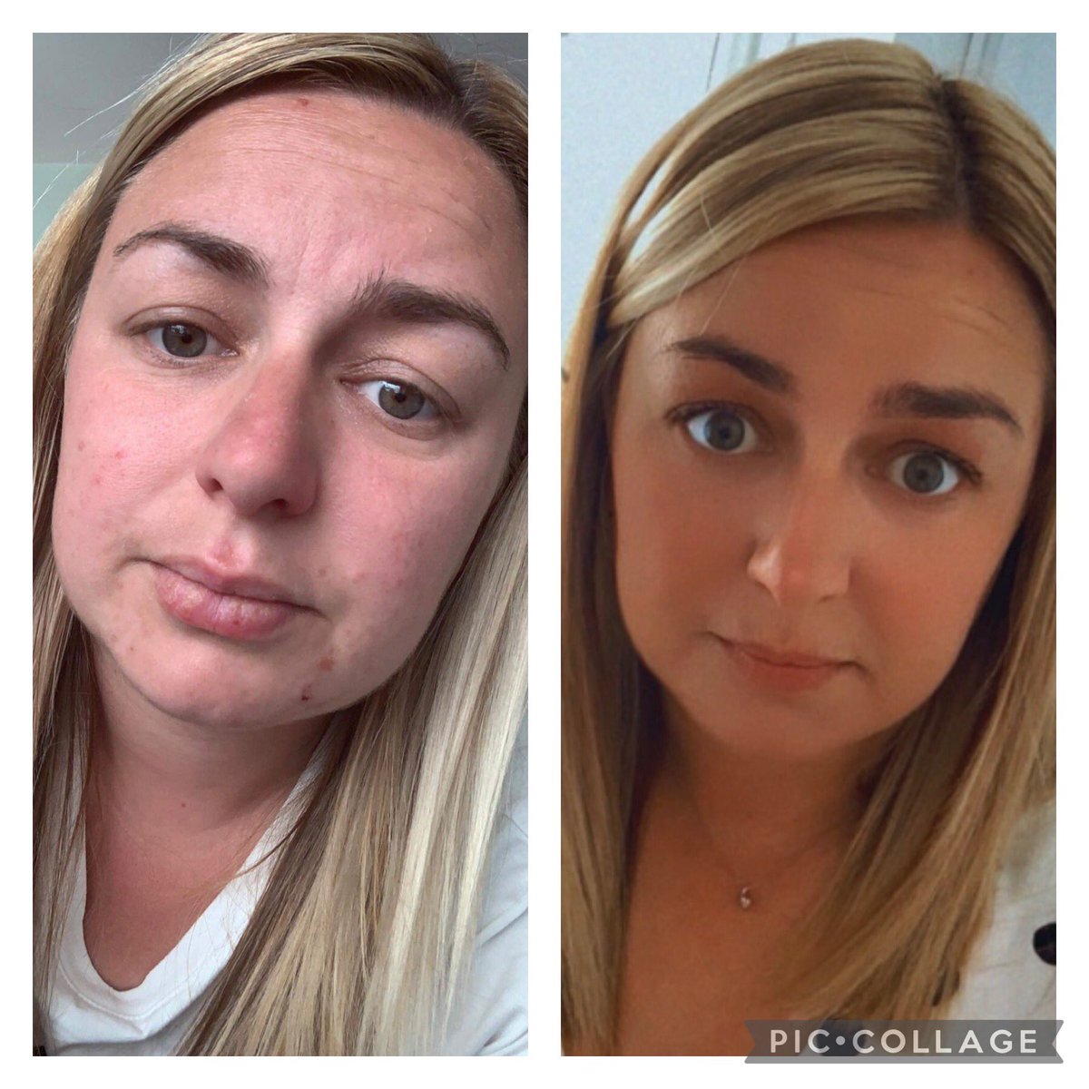 tropic_with_bex's tweet photo. Welcome to my tropic skincare page.
This page will be used to share my love of tropic, a vegan, cruelty free skincare range which I fell in love with 2 years ago 💚

I thought I would share a little bit of background information about me and how/why I found tropic 🌱 https://t.co/rncO2bsgLl