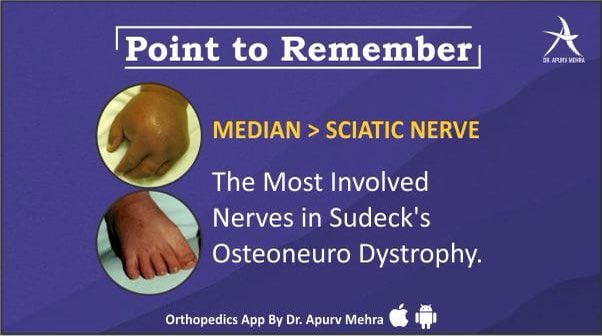 ApurvDr's tweet photo. #pointtoremember
Sudeck's Dystrophy or Complex Regional Pain Syndrome is a chronic progressive disease characterized by severe pain, swelling and skin changes, affecting mostly arms and legs.
The Median Nerve is more commonly involved than the Sciatic Nerve. https://t.co/rQM8KcH4Nv