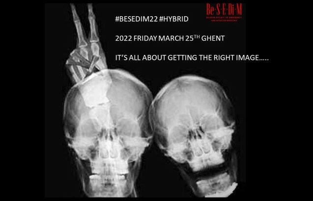 Philippe Dewolf (@dewolf1philippe) on Twitter photo 