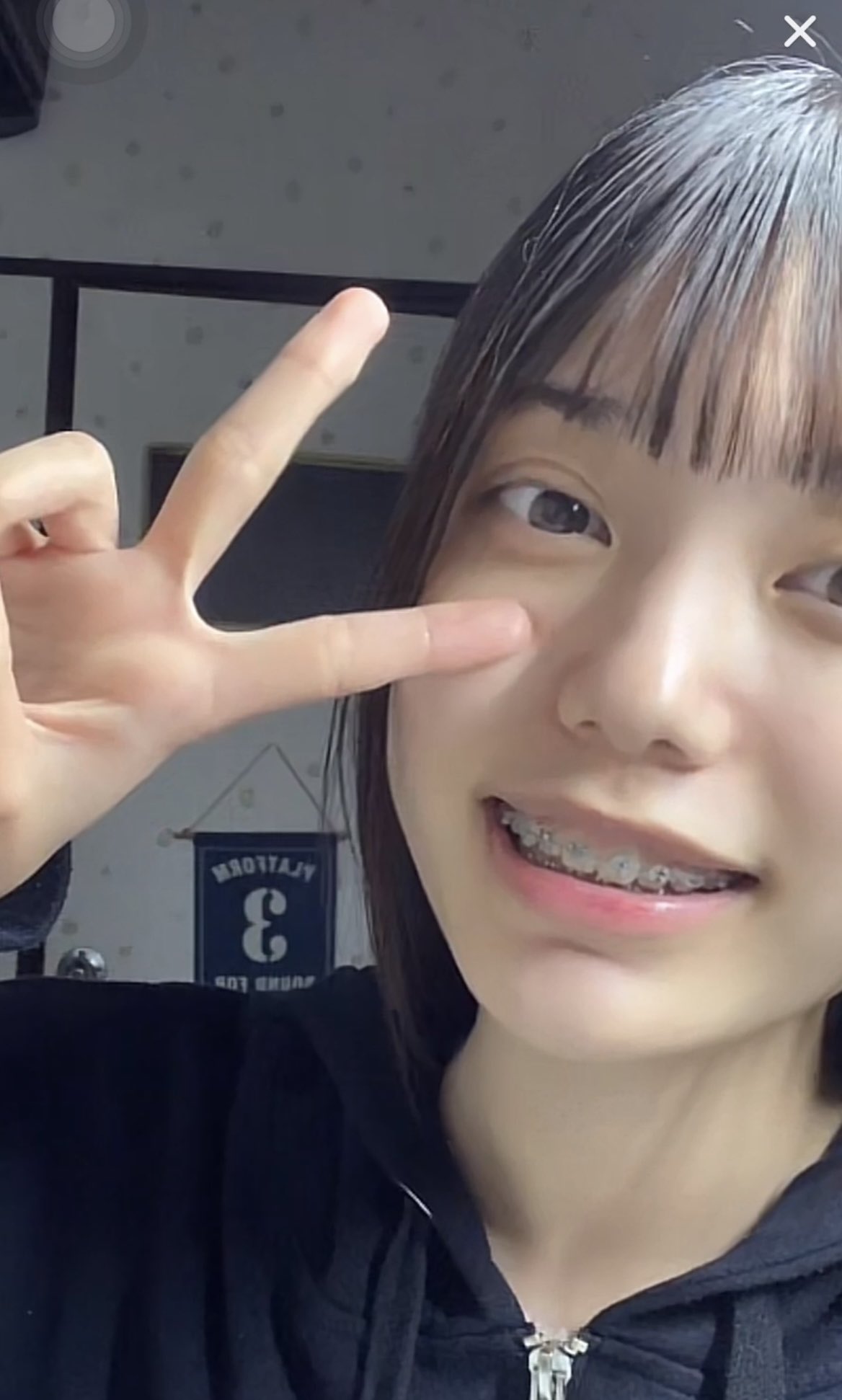 ギラギラメタル矯正 Bracescute Twitter