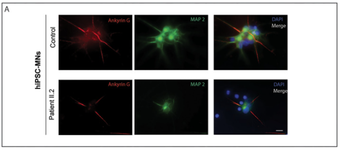 Myologie_MMG's tweet photo. And the first paper of the 2022 season is here 👇 ! Lot of great techniques and collaborators to show that mutations in #VRK1 affect the AIS and the AP in motor neurons from patients.
https://t.co/xjPFAasMib https://t.co/hpKZqwopBQ
