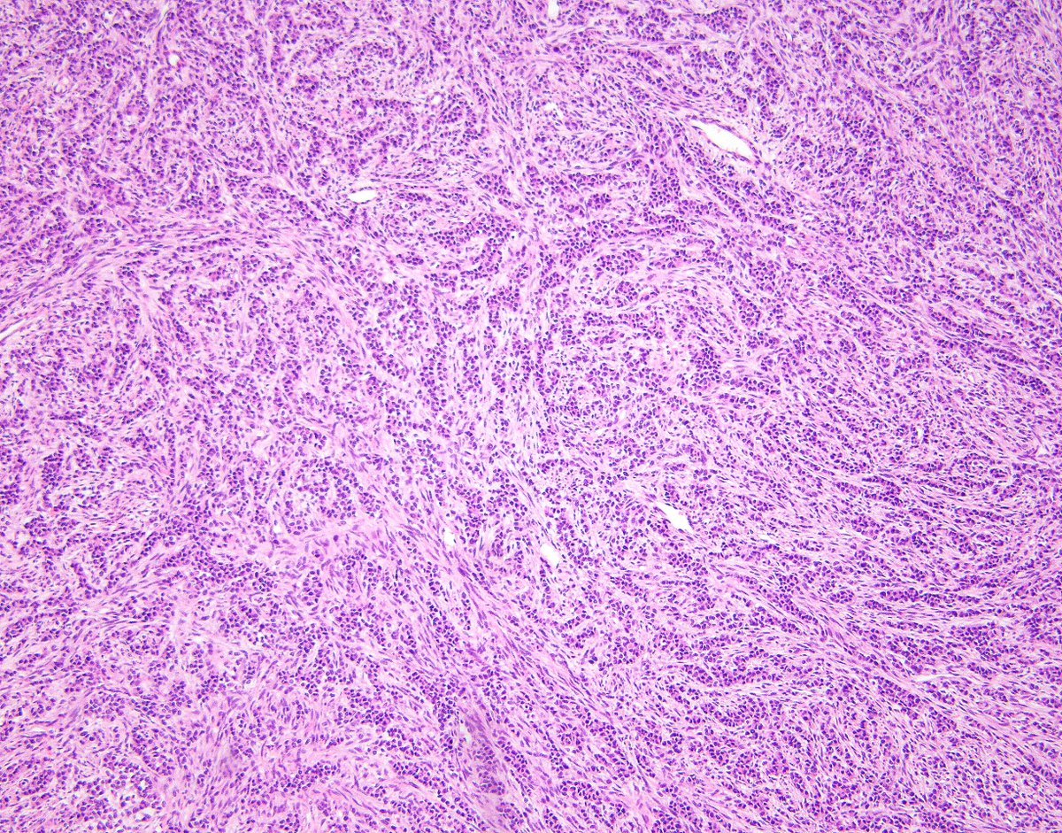 Brigham and Women's Pathology tweet media