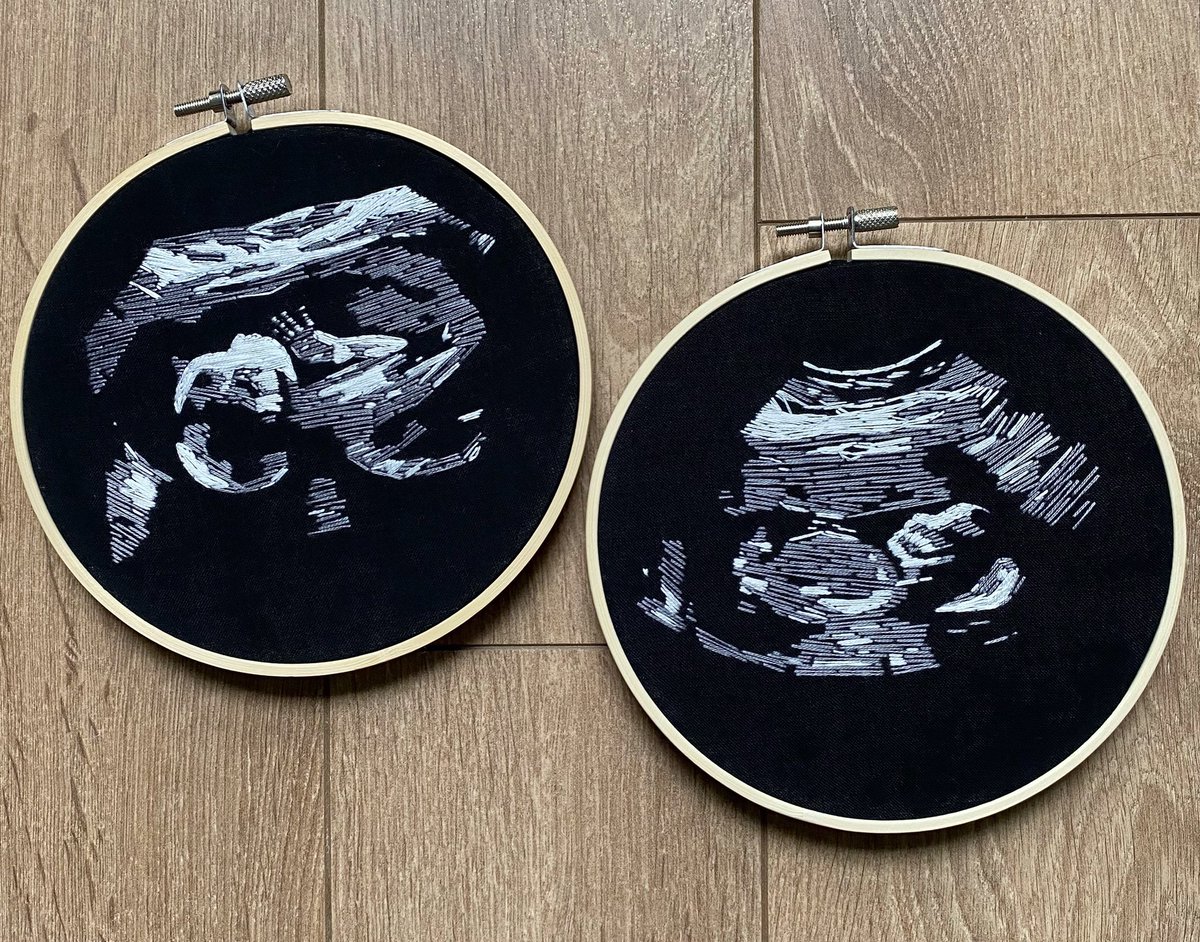Threaddurtytome's tweet photo. Custom ultrasounds 🥰
.
Available through DM https://t.co/vw5XxnMPLw