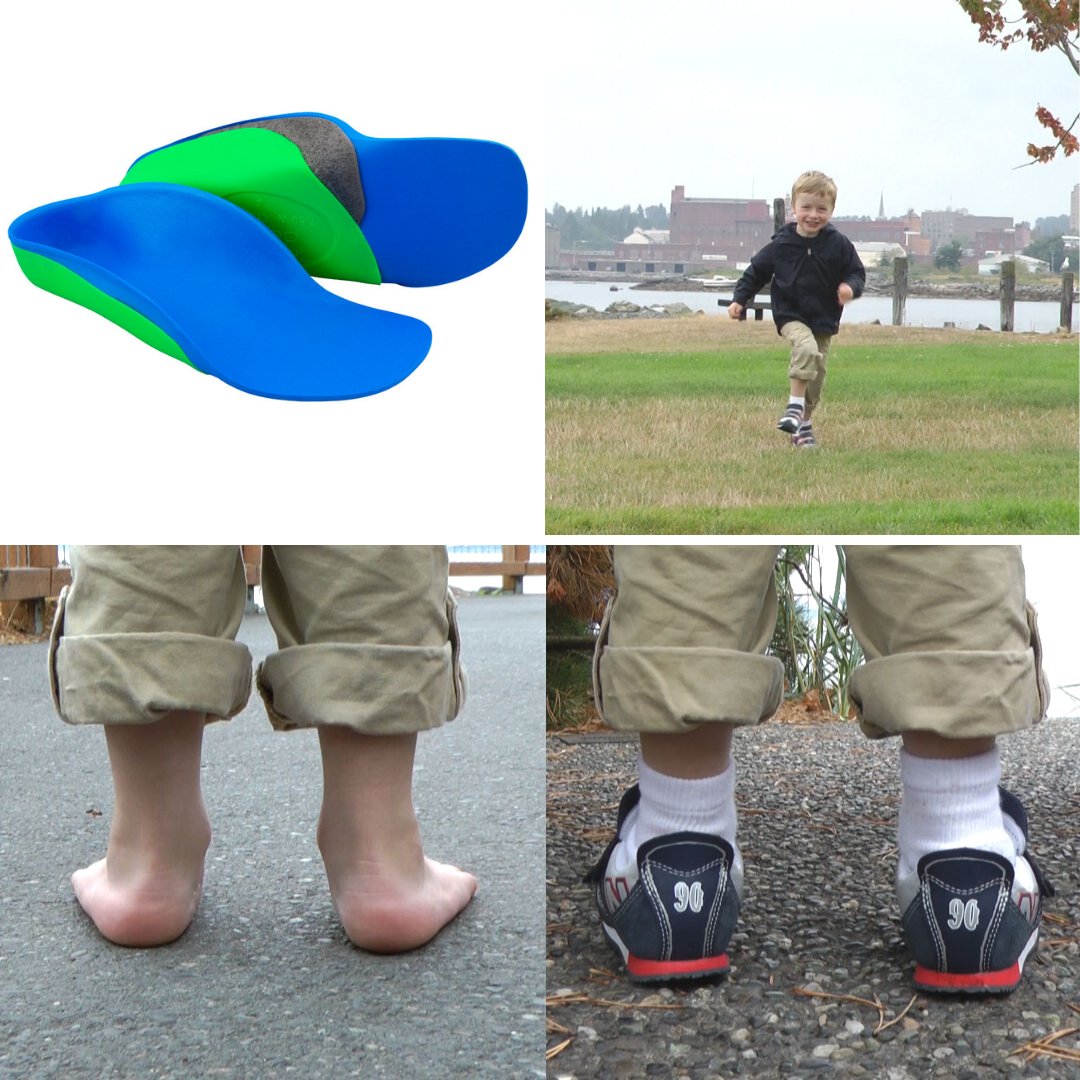 The Fast Fit Chipmunk, our maximum support, prefabricated shoe insert, is designed for patients who exhibit moderate pronation and have a fully correctable foot position. Learn more: cascadedafo.com/products/chipm…
