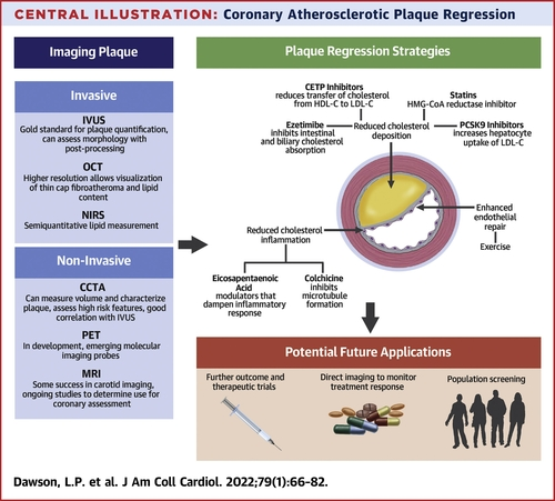 SeguraCardio's tweet photo. 📌Coronary Atherosclerotic Plaque Regression: @JACCJournals #StateOfTheArt #Review 
#CardioEd #CardioTwitter https://t.co/89LuehosHZ