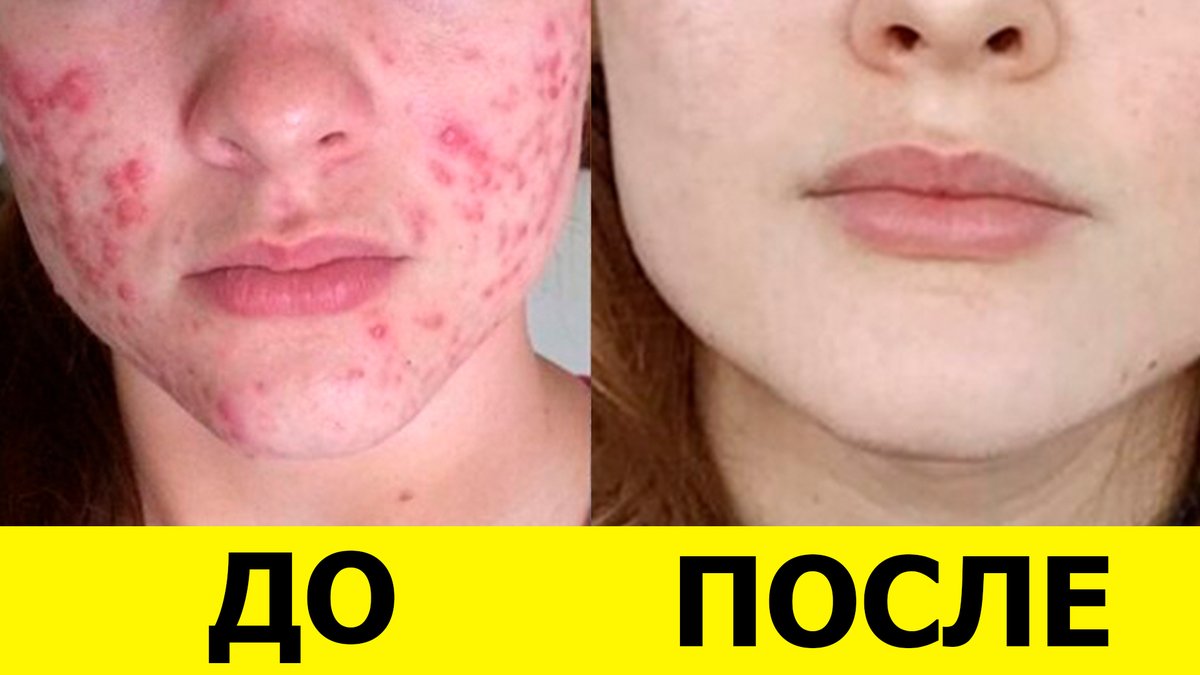 Сибирское здоровье / SiberianWellness tweet media