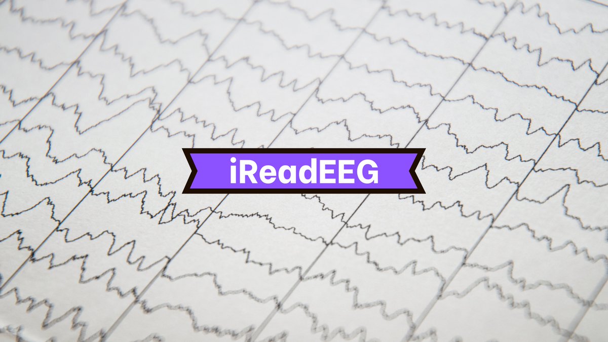 fabnascimen's tweet photo. We're investigating whether #EEGers analyze & describe routine EEG findings with or without influence of pts' clinical history or head imaging. Would you help us by filling out a short anonymous survey👇? It won't take you more than ~2 minutes! @SBeniczky
https://t.co/KECbnccrT2 https://t.co/Ll7y4CSGcu