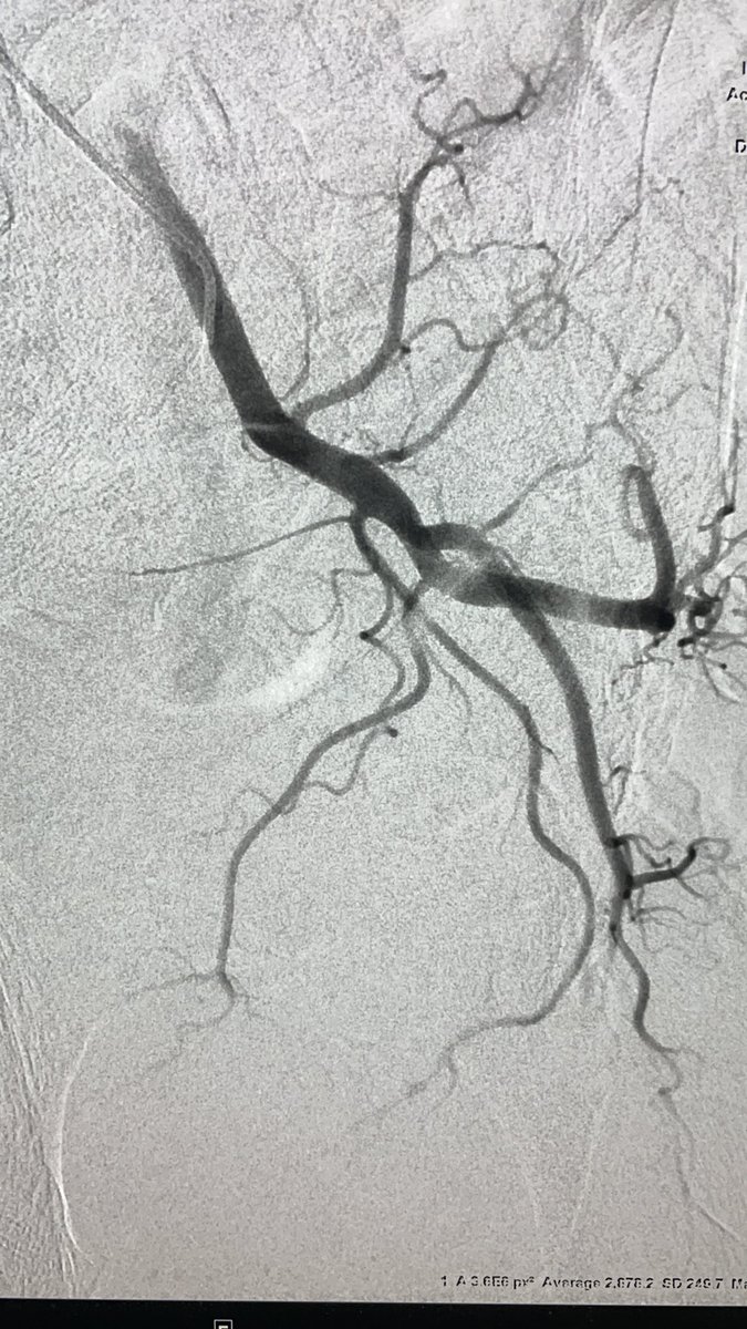 Adeel Shahid, MD tweet media