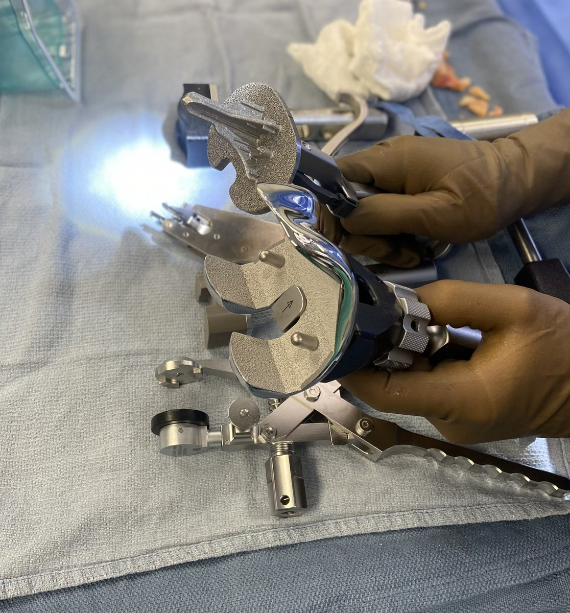 jointdocShields's tweet photo. #orthotwitter #cementless https://t.co/p4uF8uSJJH