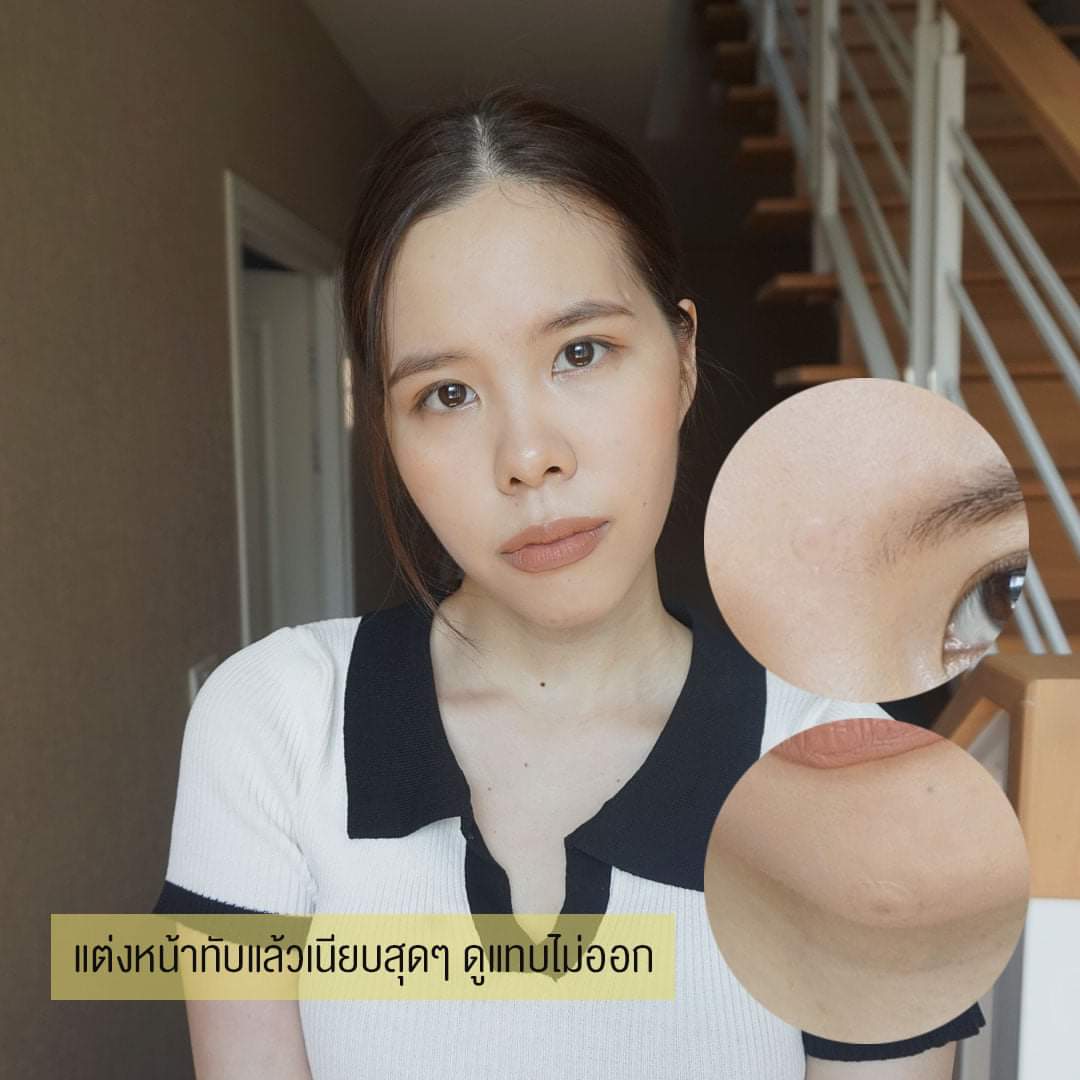 bkintheblue's tweet photo. ❤ รีวิวแผ่นดูดสิว CURESYS Niacin Active White Patch ราคาแค่ 99 บาท
- ดูดซับสิวได้ดีมาก!!
- ตัวแผ่นมีความบางแค่ 0.3 mm แปะแล้วเนียนสนิท แต่งหน้าทับได้
- มีวิตามินบี 3 ที่ช่วยลดรอสิวให้จางไวขึ้น
โดยใน 1 ซองมีทั้งหมด 18 ชิ้น
#ไว้รีวิวห้ามขายของโว้ยย #แผ่นแปะสิว #curesys @curesys https://t.co/8Xaba6qXvN