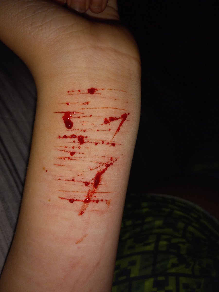 LSER66722307's tweet photo. TW//SH 
.
.
.
.
.
.
.
.
.
.
.
.
.
.
.
Had a little fun
Catscratchestwt barcodetwt styro redbreadtwt 198twt sh twt ouchietwt beanstwt https://t.co/m0uSS3J4fe