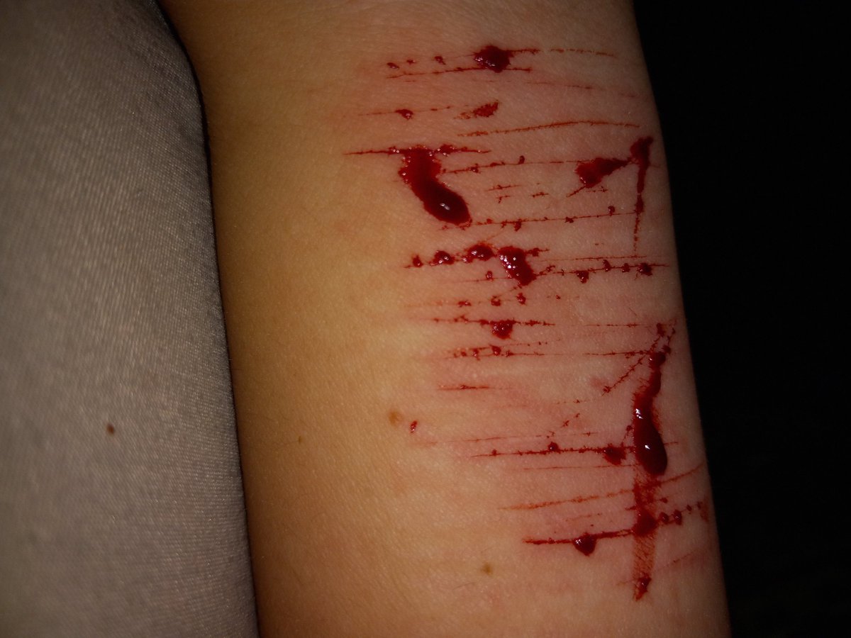LSER66722307's tweet photo. TW//SH 
.
.
.
.
.
.
.
.
.
.
.
.
.
.
.
Had a little fun
Catscratchestwt barcodetwt styro redbreadtwt 198twt sh twt ouchietwt beanstwt https://t.co/m0uSS3J4fe