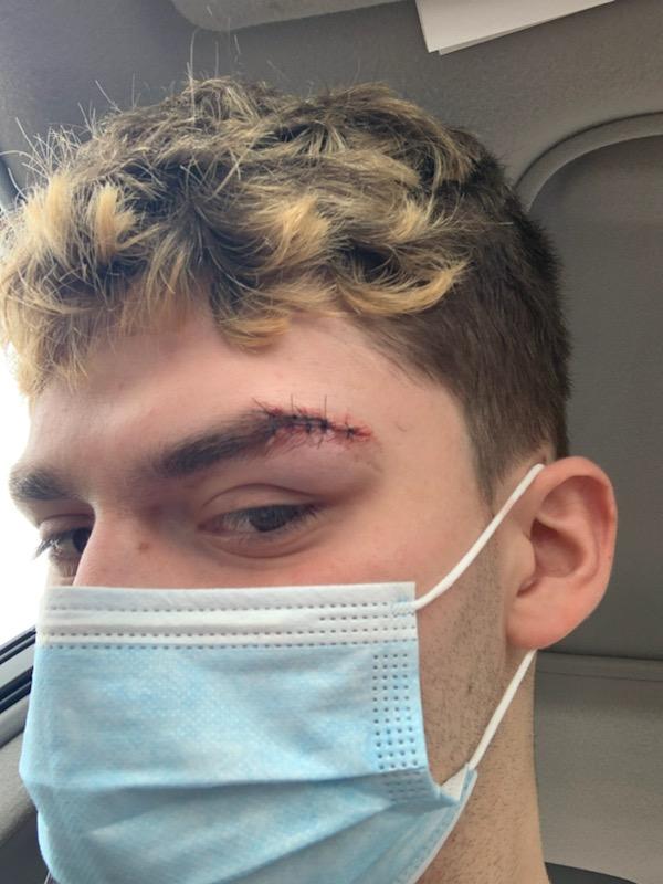 JGElmore10's tweet photo. Happy Birthday CJ! This guy makes me so proud! His body and luck have taken a beating this year....Stitches &amp; head blow for New Years🤦😩- but he inspires me daily! Love you! https://t.co/FIeBjFfmnf