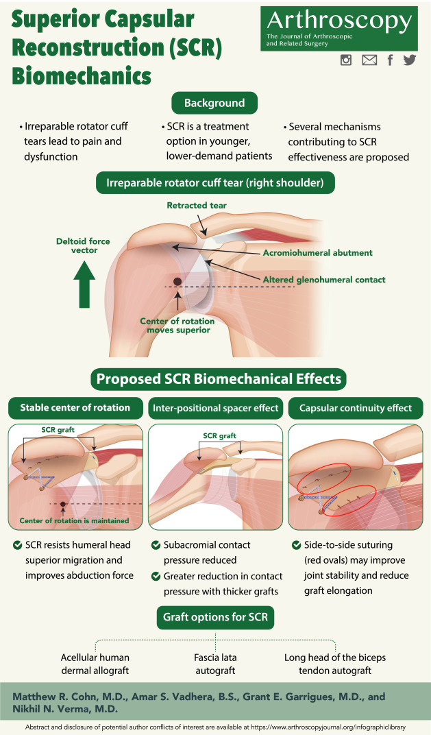 Start off 2022 by learning about the biomechanical advantages of SCR in January's infographic  <a href="/Grant_Garrigues/">Dr. Grant Garrigues</a> <a href="/DrNikhilVerma/">Nikhil N. Verma, MD</a> 

arthroscopyjournal.org/article/S0749-…