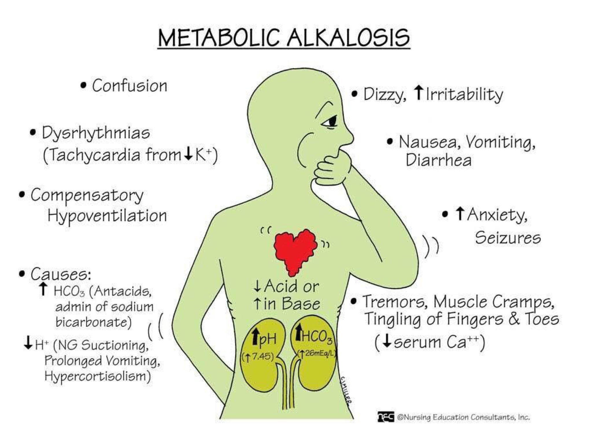 Metabolic Alkalosis