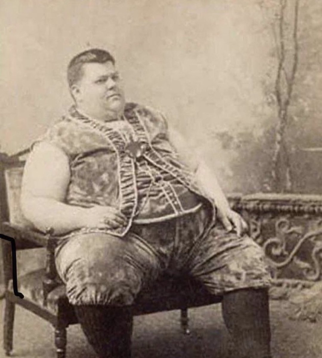 SBakerMD's tweet photo. In 1890 this guy was considered the fattest man in the world and people paid money to see him! Today he wouldn’t even get a second look! https://t.co/p60bsf8FKN