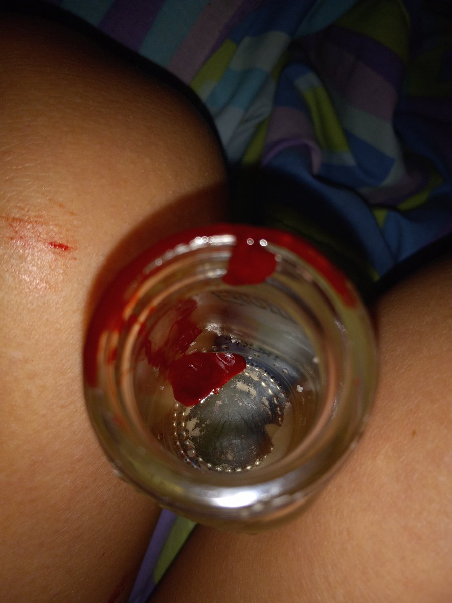 LSER66722307's tweet photo. Had some more funnnn TW//SH 
.
.
.
.
.
.
.
.
BARCODETWT STYRO REDBREADTWT 198TWT SH TWT OUCHIETWT CATSCRATCHESTWT BEANSTWT https://t.co/PfbCyODZti