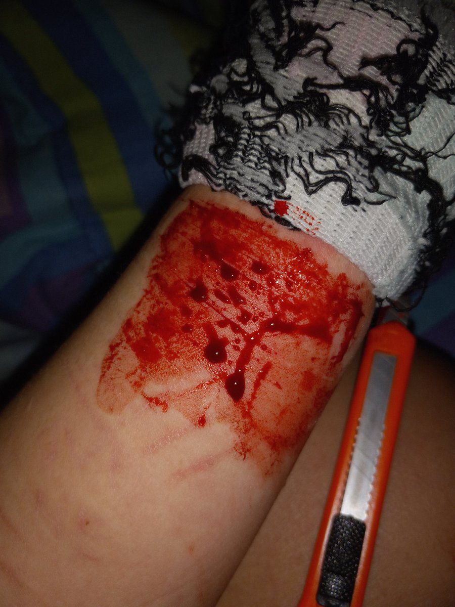 LSER66722307's tweet photo. Had some more funnnn TW//SH 
.
.
.
.
.
.
.
.
BARCODETWT STYRO REDBREADTWT 198TWT SH TWT OUCHIETWT CATSCRATCHESTWT BEANSTWT https://t.co/PfbCyODZti