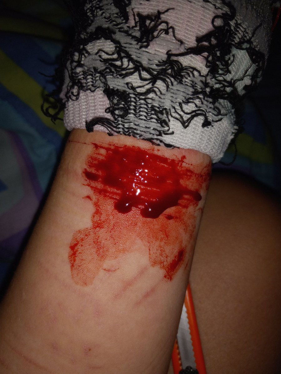 LSER66722307's tweet photo. Had some more funnnn TW//SH 
.
.
.
.
.
.
.
.
BARCODETWT STYRO REDBREADTWT 198TWT SH TWT OUCHIETWT CATSCRATCHESTWT BEANSTWT https://t.co/PfbCyODZti