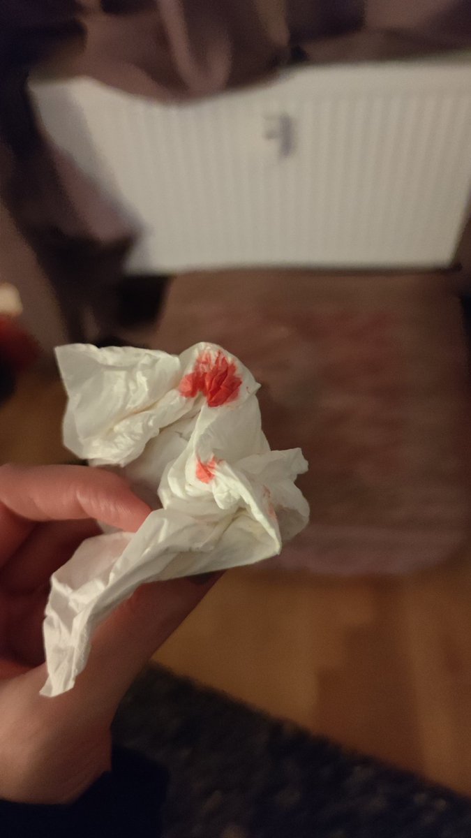 SusanWayland's tweet photo. Oh nooo nose bleeding... Surprise blood pressure on tall people.😱 #Sarcasm #ectomorph #instastars 🤣 https://t.co/46HxaCYrsa