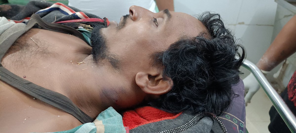 बाग थाना अंतर्गत ग्राम पंचायत भत्यारी में 
वर्तमान सरपंच ने रंजिश के चलते गांव के जयस युवाओ पर पिस्टल से की फायरिंग तीन युवक को लगी गोली एक युवक की हालात गंभीर <a href="/collectordhar/">Collector Dhar | कलेक्टर धार</a> <a href="/PROJSDhar/">Jansampark Dhar । जनसंपर्क धार</a> प्रशासन आरोपियों को तत्काल गिरफ्तार करें वरना होगा आंदोलन...! <a href="/jays_officia1/">JAYS | Jai Adivasi Yuva Shakti</a> <a href="/anandrai177/">Office Of Dr Anand Rai</a>