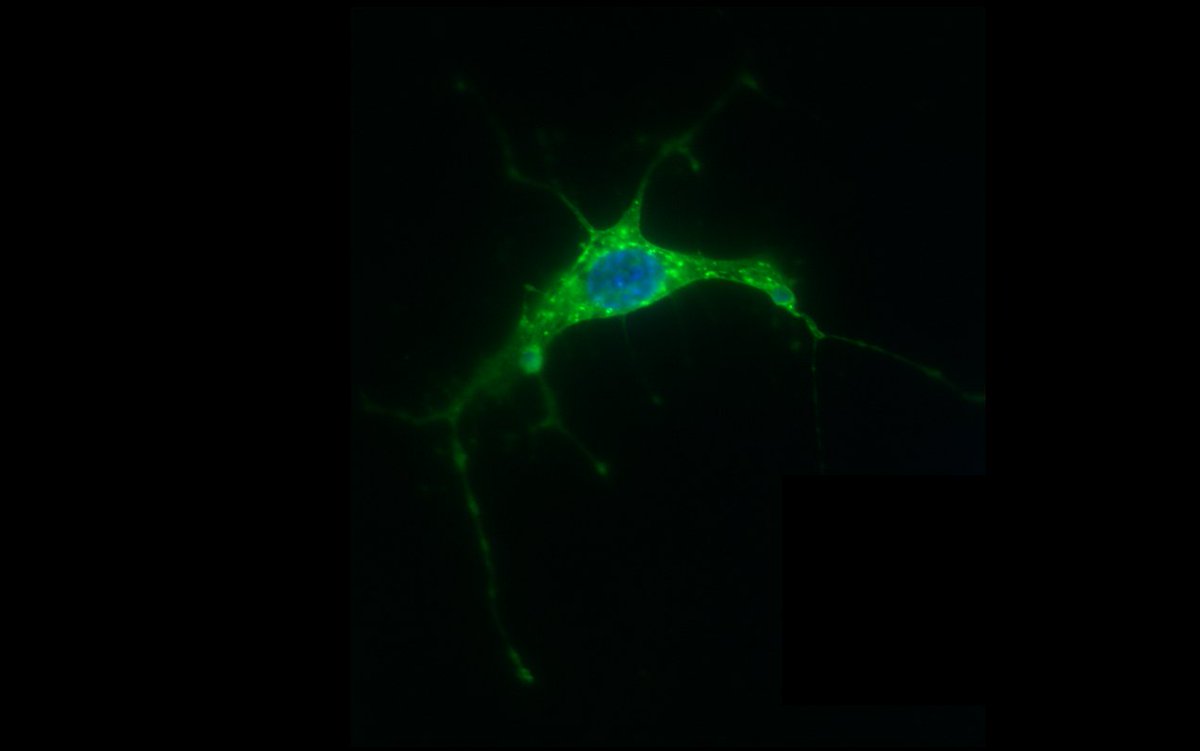 MMears_'s tweet image. It's happening. I'm starting to write full time! 😱

PLEASE send all of your best wishes, writing hacks, tips, and tricks, as I try to tackle this #Dissertation!

@OpenAcademics @AcademicChatter #AcademicTwitter #PhDchat