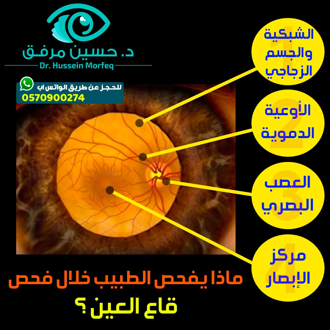 فحص قاع العين الموسَّع مهم لبعض فئات المجتمع مثل:قصر النظر الشديد، مرضى السكري، انفصال الشبكية، التهاب القزحية، التهاب العصب البصري، ضعف النظر التدريجي او المفاجئ، العشى الليلي

#صحتك_حياتك #توعية_صحية #عيون #طبيب_عيون #جدة #السكري #الشبكية  #صحة_عينك #النظر <a href="/6abeb_/">#صوت_الطبيب🩺</a> @Voice_6abeb