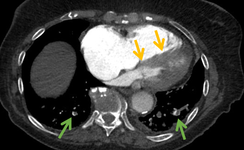 Julie Bulman, MD tweet media