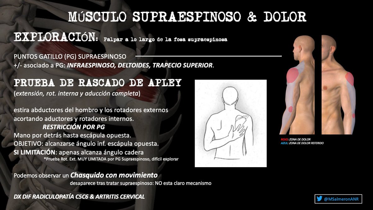 MSalmeronANR's tweet photo. 📍EL MÚSCULO SUPRAESPINOSO Y SU RELACIÓN CON EL #DOLOR DEL #HOMBRO

📚 Os traigo un resumen de la clínica😖, exploración💪🏼 y medidas que podemos adoptar🙌🏼 
en la patología asociada al dolor en el 
músc. supraespinoso. @Sedolor 

Sonoanatomía del Músc. Supraespinoso en el hilo... https://t.co/4zmRWB9HMD