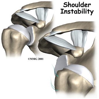 Is your shoulder giving up on you? But you NEVER give up!
Give Instability the Cold Shoulder!
Click below:
fyzical.com/algonac/Injuri…

#shoulderpain #cause #treatment #fyzicalalgonac #painmanagement #symptoms #physicaltherapy #LoveYourLife #shouldersprain #shoulderinstability