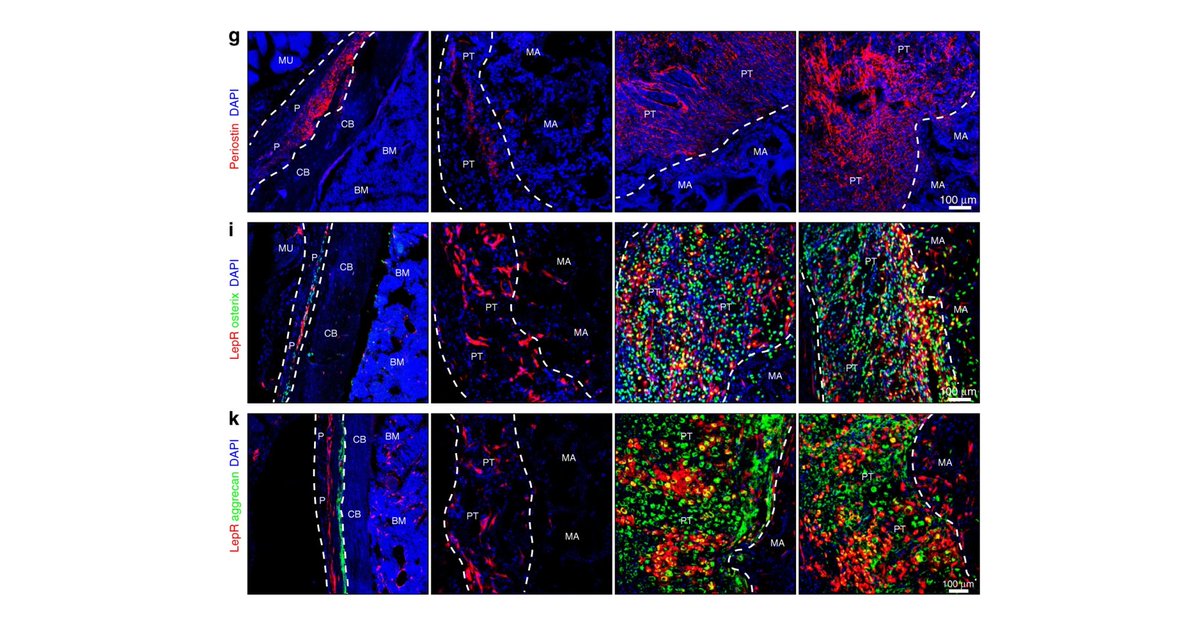 MesenchymalCell's tweet image. The generation of periosteum-mimicking tissue has become a novel strategy for #BoneRegeneration. 🦴

This new paper introduces a novel biomimetic strategy for generating periosteum-like tissue through in vivo endochondral #ossification. 

➡️ go.nature.com/3qKeFSt