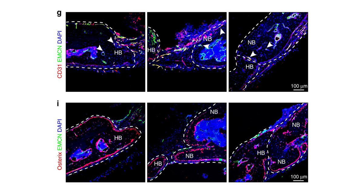 ExtracellMatrix's tweet photo. Researchers at the East China University of Science and Technology utilized a bone morphogenetic protein-2-loaded #scaffold to create periosteum-like tissue in vivo, mimicking the mesenchymal condensation during native long #BoneDevelopment. 🦴
Read more: https://t.co/O5hUfC7SHm https://t.co/Tt3CK4YGJd