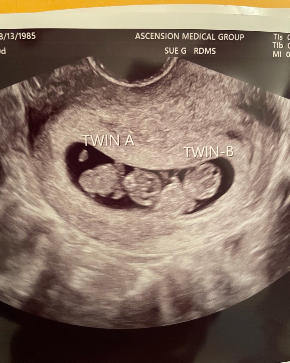mz_taina's tweet photo. BOYS? OR GIRLS?? Twins coming July 2022 https://t.co/vtYIgGURss