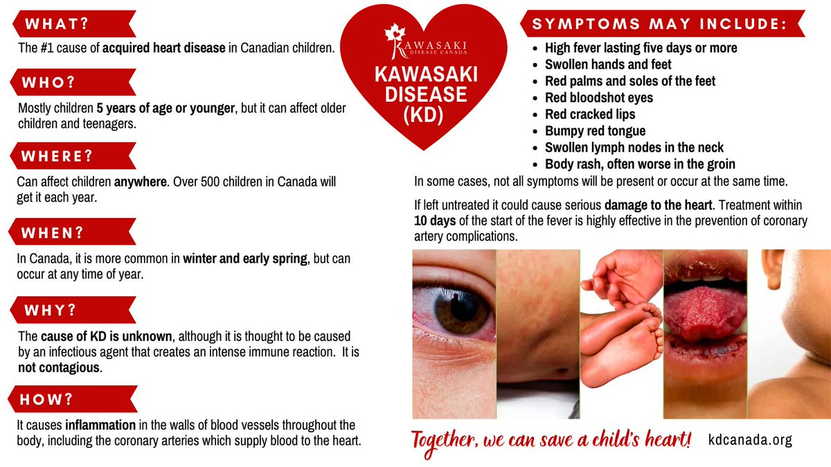 January 26th is Kawasaki Disease Awareness Day. We will be posting throughout the month to raise awareness.  

What is Kawasaki disease(KD)? #Kawasakidisease is the leading cause of acquired heart disease in Canadian children. Early detection is critical.  kdcanada.org