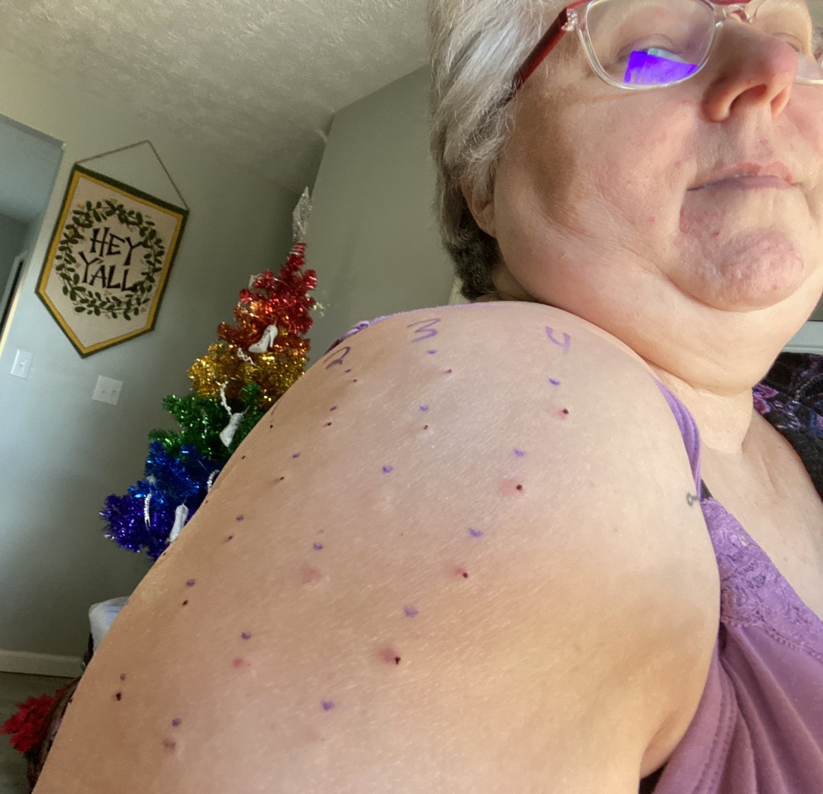 wabbittts's tweet photo. Hey Y’all had allergy tests today and I have just enough of a headache to make streaming uncomfortable. See everyone Thursday! Love to All! ❤️ https://t.co/dmwxMijY4p