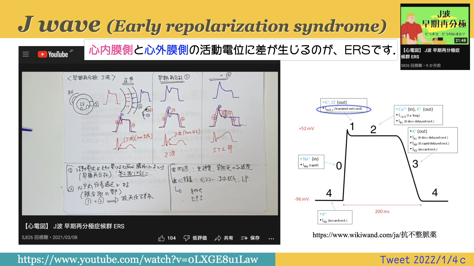N. Tsukishima EP大学心電図検定学部試験対策科担任 on X