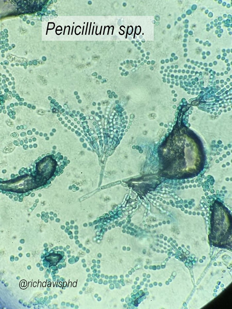 richdavisphd's tweet photo. #MicroRounds (Day 875): At first glance, a tech called the left mold Penicillium. It's a lookalike, but it's actually Scopulariopsis.
This isolate shows 3 key Scopulariopsis features (but not 1 fun one) that can help identify this mold.
What are they? #ASMClinMicro #IDTwitter https://t.co/rHGM7jrwDW