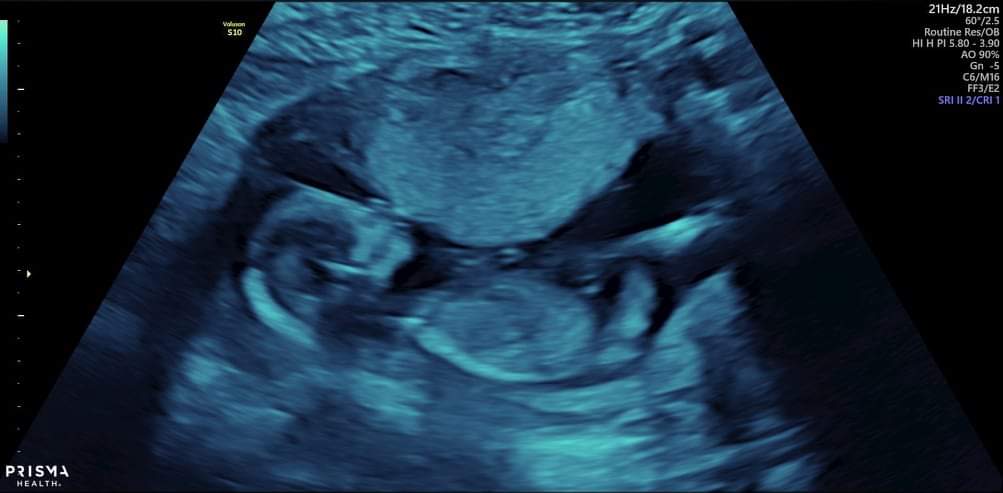 I can't wait to meet my baby Bleu!!!!