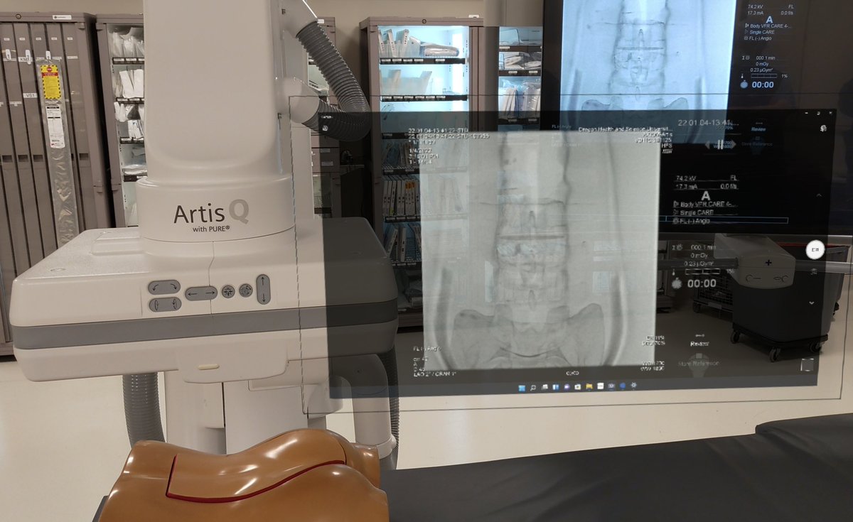 Virtual #AR procedural monitors w real-time fluoro streamed into <a href="/HoloLens/">Microsoft HoloLens</a> 2. Place these wherever you want, however big you want! No more turning your head, looking across the room, or asking #IR techs to adjust the screen. #FutureOfIGT <a href="/dotter_IR/">The Dotter Institute</a> <a href="/SiemensHealth/">Siemens Healthineers</a> <a href="/SIRspecialists/">Society of Interventional Radiology</a>