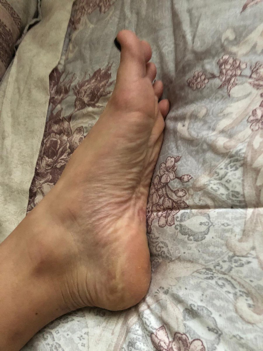 Sanal seans için müsaitim bu ayakları gırtlağıniza kadar sokmami istiyorsaniz yazın ... #finansalkole #kole #sahibe #ayakfetisi #footfetish #footworshi̇p #ayak #corap #scat #pising