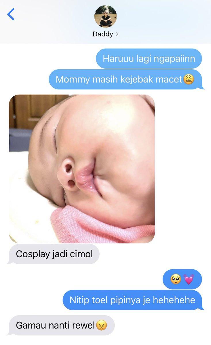 lapaknarasi's tweet photo. Ditinggal pergi Aca
-
[Jeje &amp;&amp; Aca One Tweet AU] https://t.co/f5rwOMpeBQ