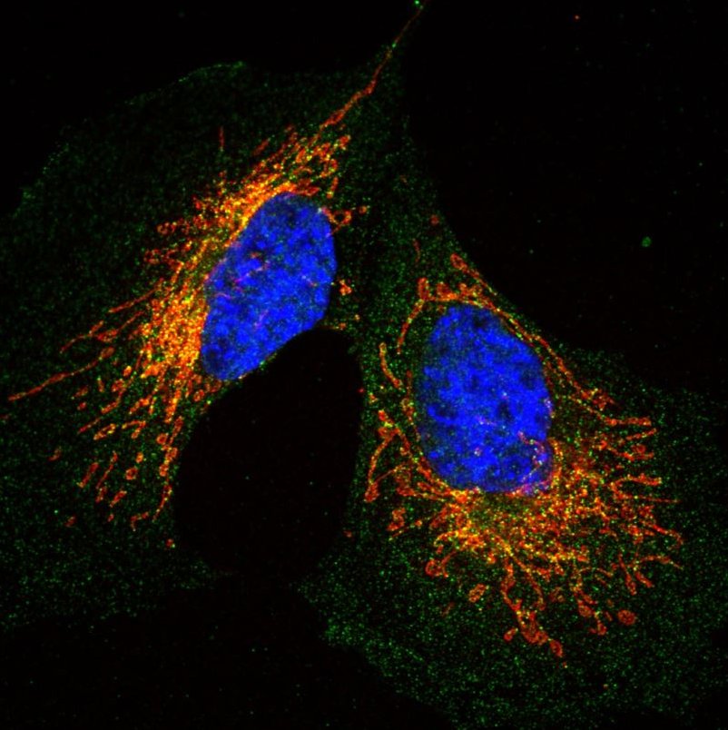 📢Excited to announce our 3yr Bloomsbury #PhDstudentship is open for applications!

Work with me @RoyalVetCollege and @irileniaN @BirkbeckUoL to protect #mitochondria in #neonatalbrain 🧠 after injury

🗓️closes 6th Feb 🌟more info here👇
rvc.ac.uk/study/postgrad…

🔊Please RT👍