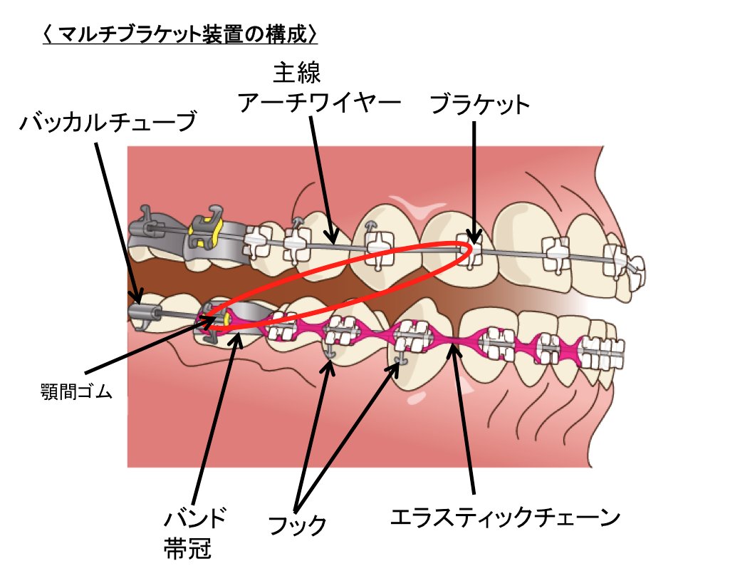 マルチブラケット装置の構成】