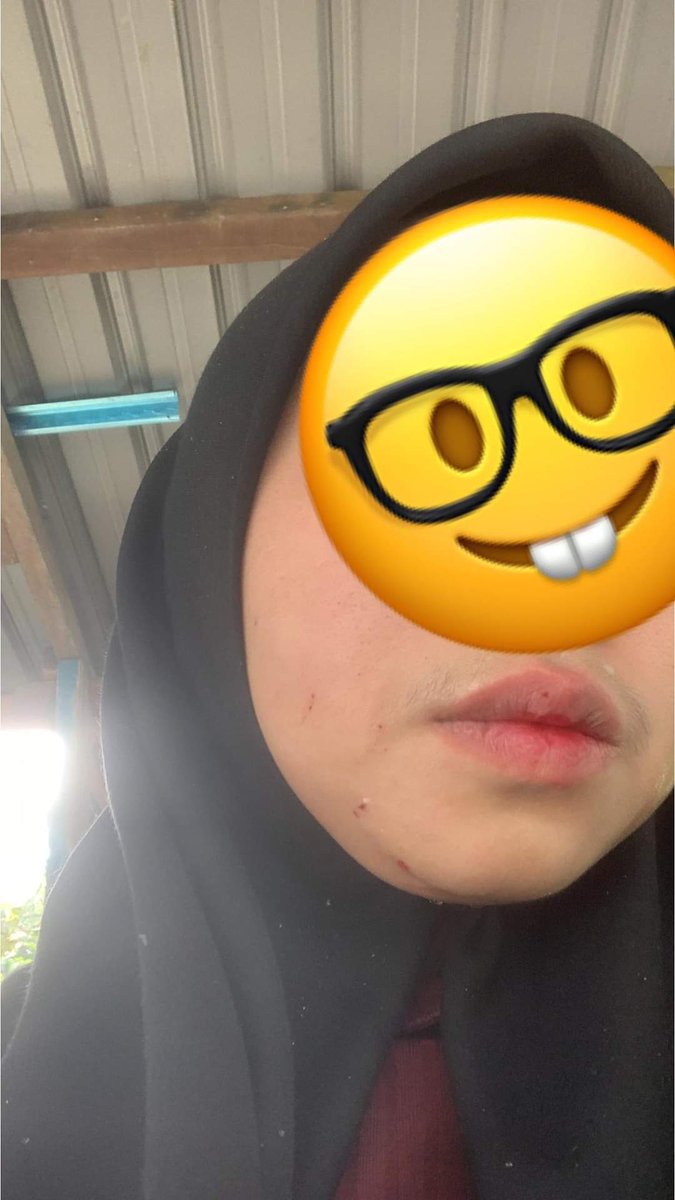 isusemasaviral's tweet photo. Kau da la potong lori xlepas kau himpit aku pastu aku benti tepi kau patah balik kau lari eh hala jb 👍🏻
Owner bezza merah bangsa cina org taman u skudai plat kete JSQ 3299 report da buat kau tunggu je polis jalan kerja 🙏🏻

Sumber: Syakila Abdull https://t.co/u1SIMNQtbE